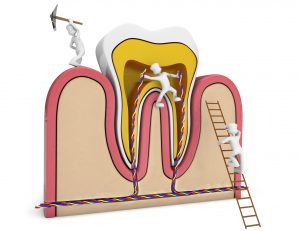 germs destroying a schematic tooth section. 3d image.