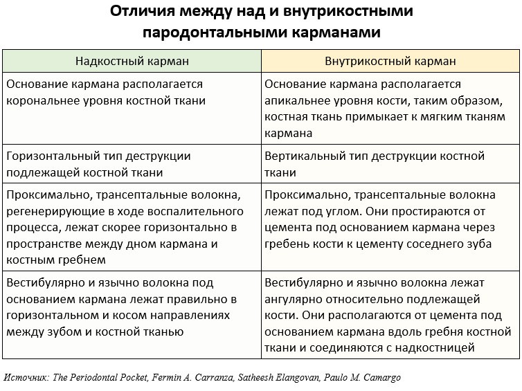 Отличия между карманами