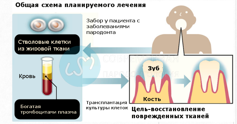 Диагностика заболеваний пародонта. Регенерация тканей пародонта. Тканевая регенерация пародонта. Регенерация зубов из стволовых клеток.