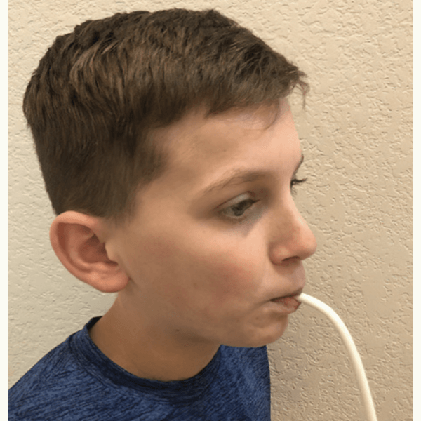 Пациент смыкает губы при использовании слюноотсоса