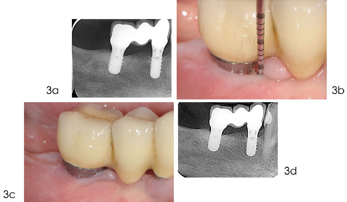 Динамическое наблюдение (поддерживающая терапия)