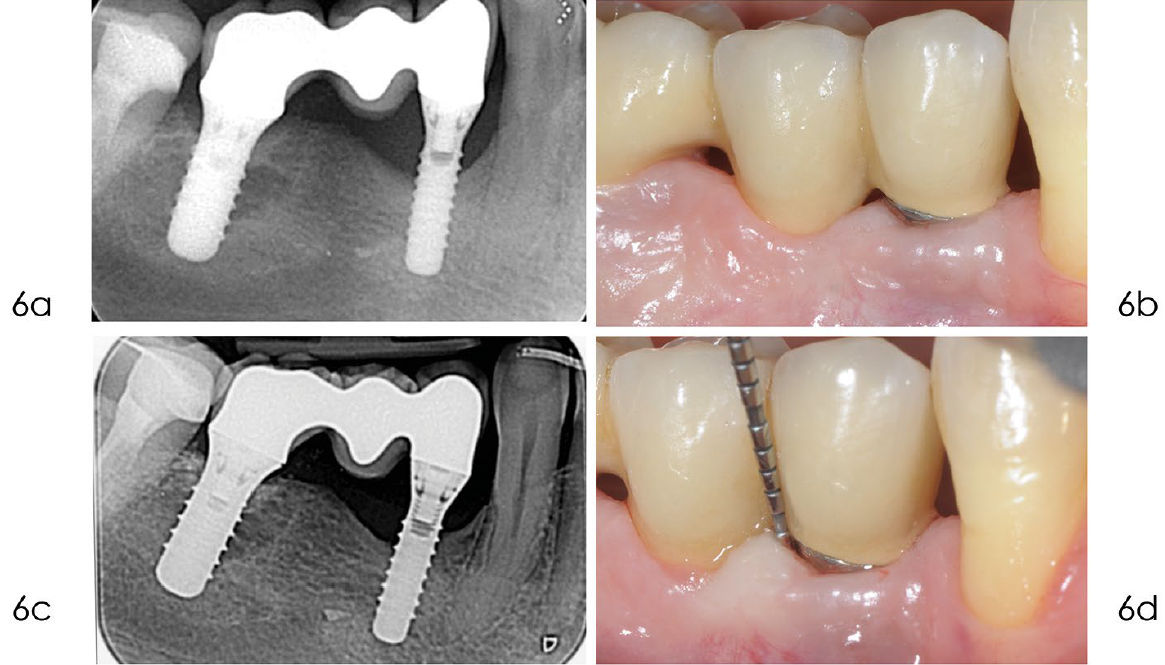 Рентгенограмма, выполненная в сентябре 2020 года