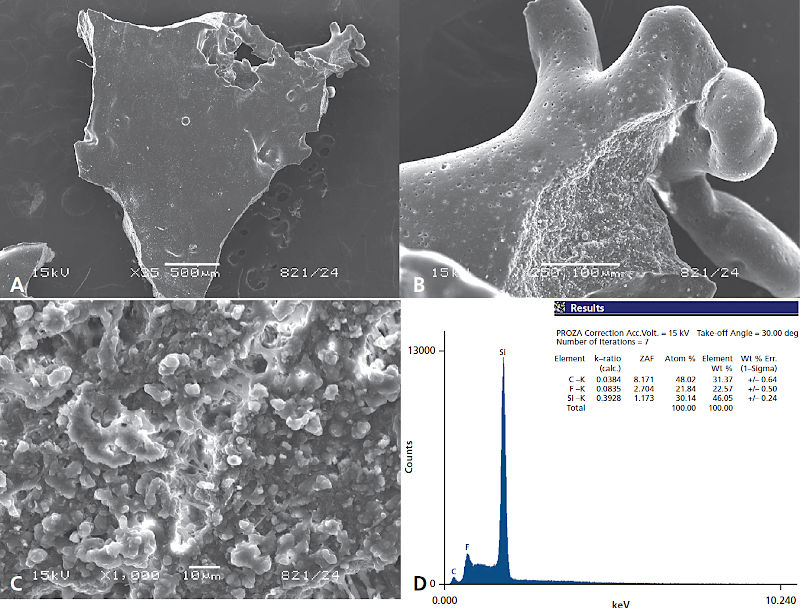 Микрофотография, полученная методом сканирующей электронной микроскопии