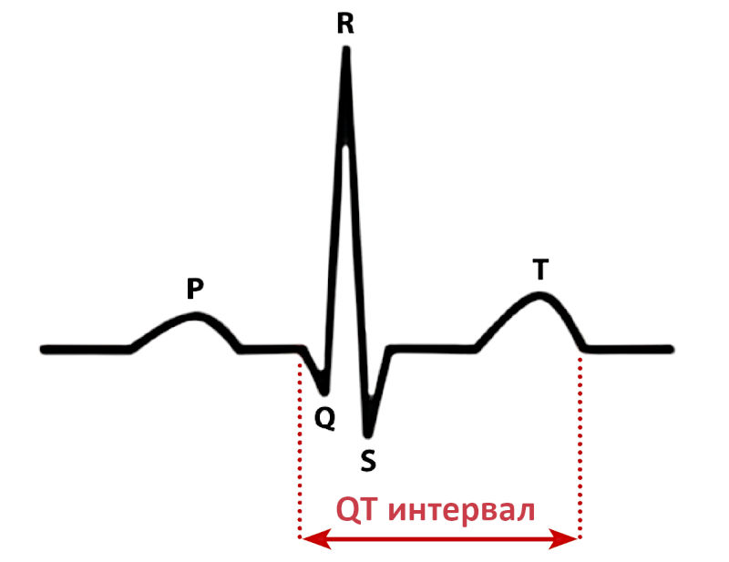 Электрокардиограмма с обозначением интервала QT