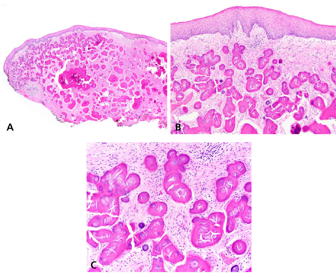 Паракератинизированный многослойный плоский эпителий