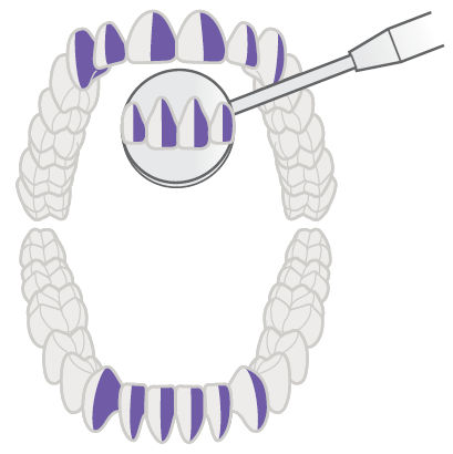 Передние поверхности, обращённые от врача-правши