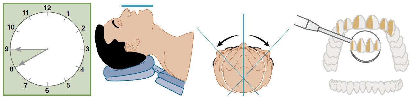 Передние поверхности верхней челюсти, обращённые к врачу
