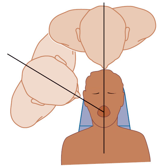 Перемещение вокруг пациента