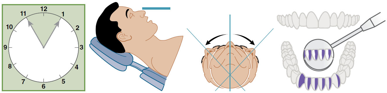 Передние поверхности нижней челюсти, обращённые от врача