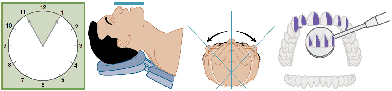 Передние поверхности верхней челюсти, обращённые от врача