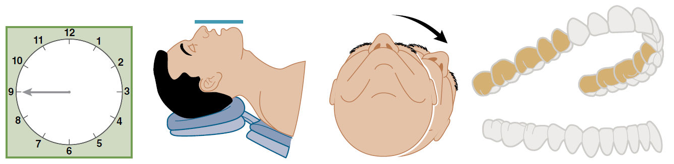 Дистальные участки верхней челюсти, обращённые к врачу