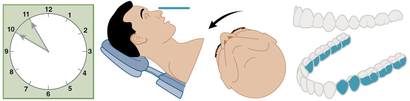 Дистальные участки нижней челюсти, обращённые от врача