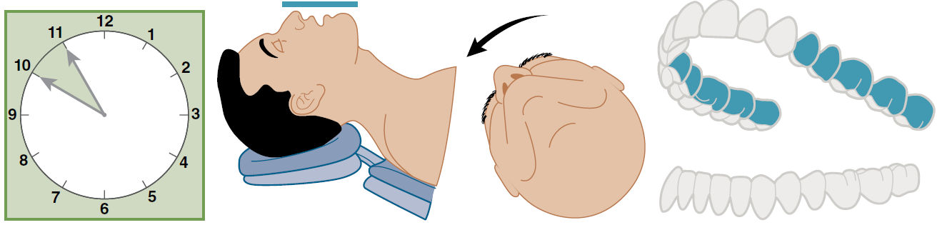 Дистальные участки верхней челюсти, обращённые от врача