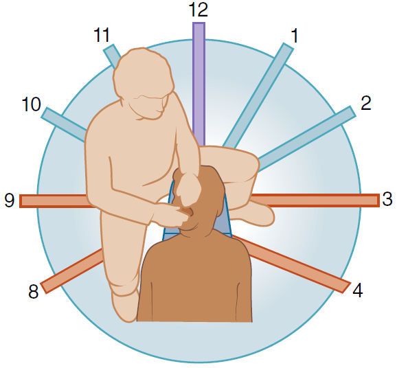 Позиции врача по циферблату