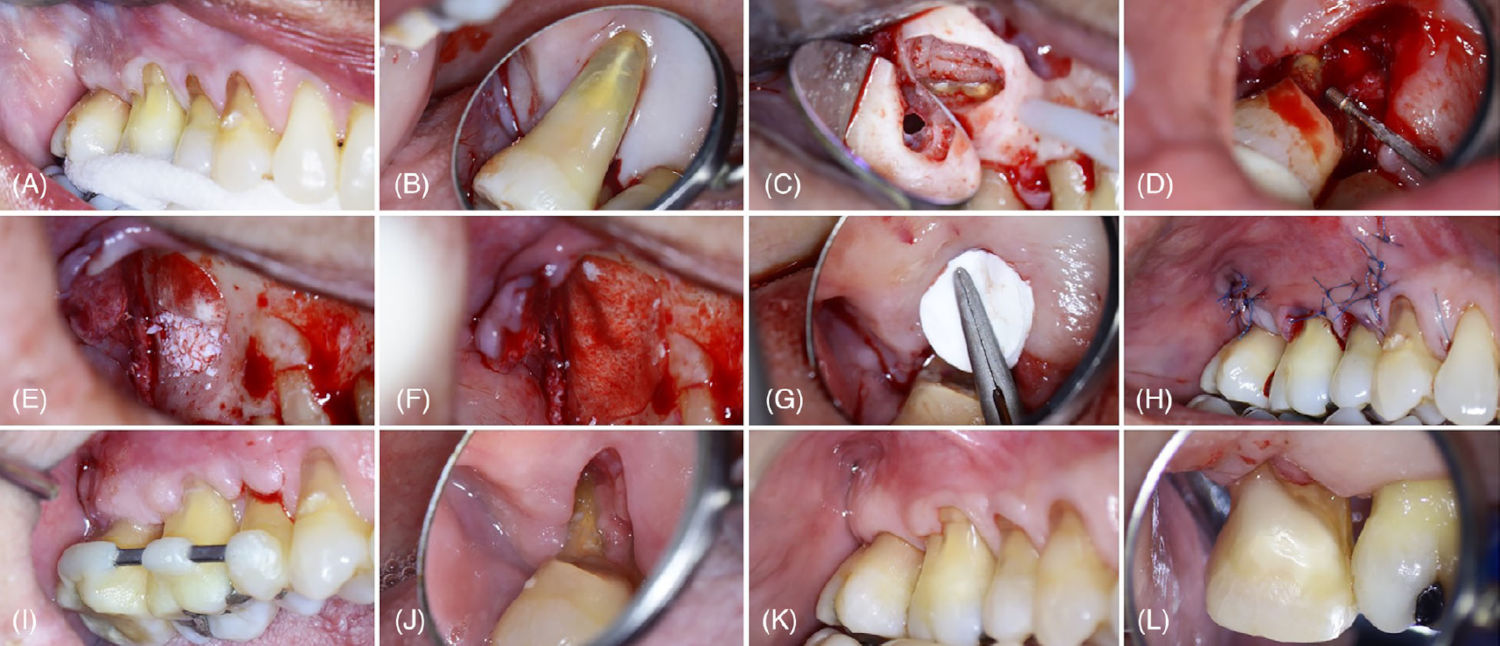 Исходный вид со щёчной стороны