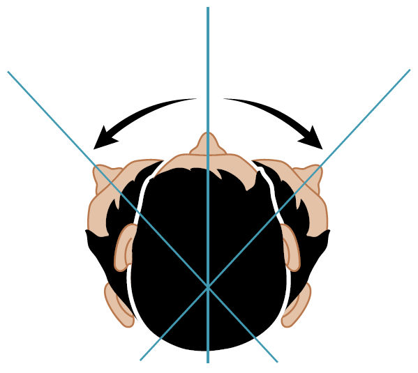 Положение головы пациента