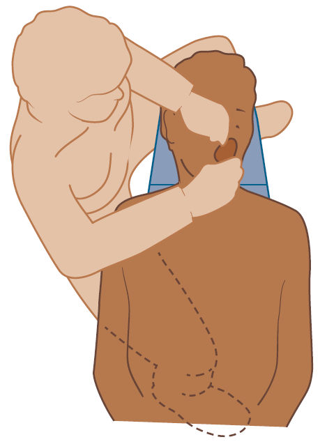 Позиция 9 часов (сбоку от пациента)