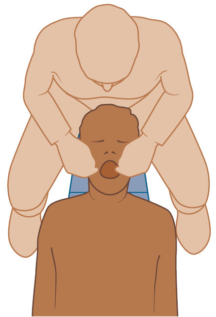 Позиция 12 часов (позади пациента)