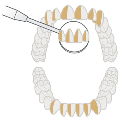 Передние поверхности, обращённые к врачу-правше