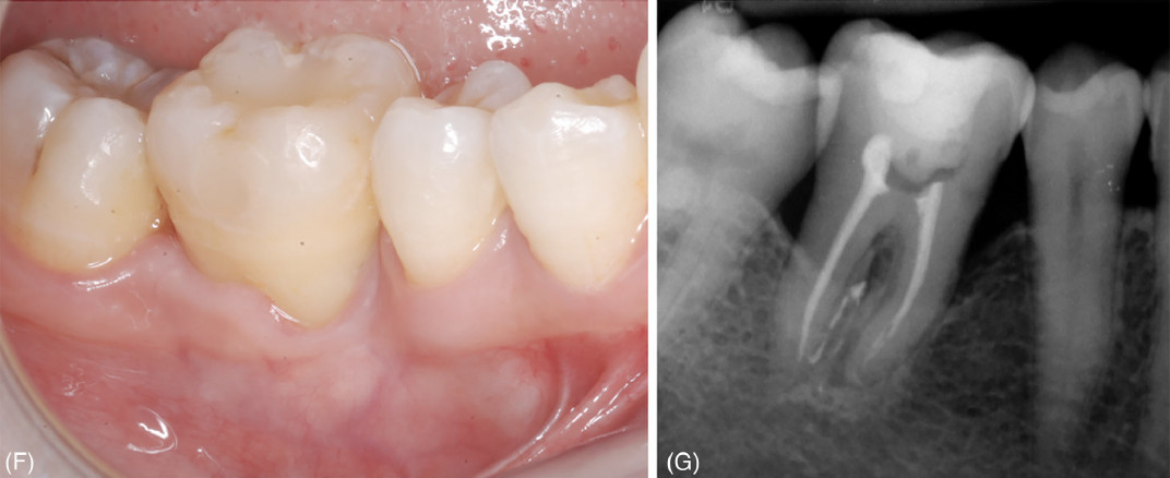 Клиническое обследование через 24 месяца наблюдения